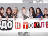 ТВ-программа "До и После"